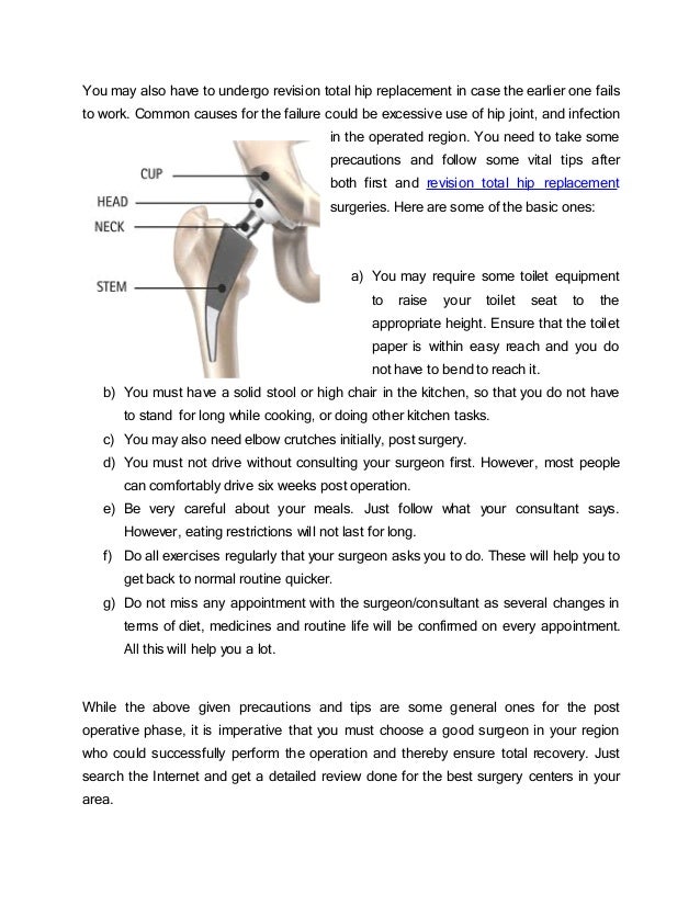 Precautions and tips related to total hip replacement surgery and its…
