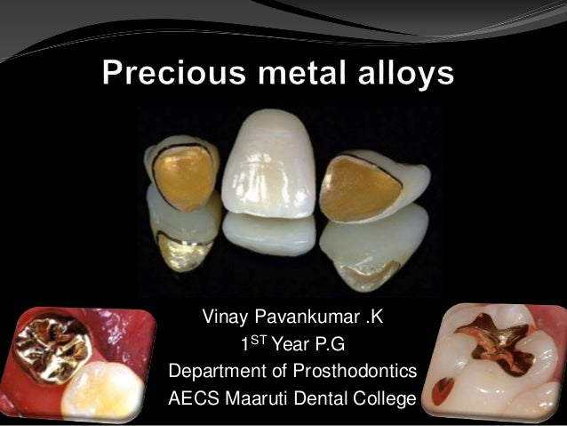 Gold Prongs Clipped To Eye Teeth