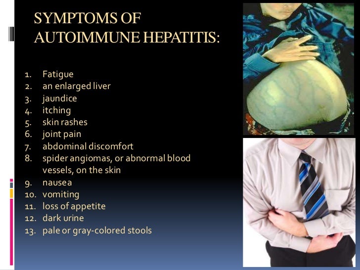 liver mediated diseases and viral hepatitis