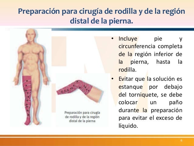 Preparación de la piel para cirugía