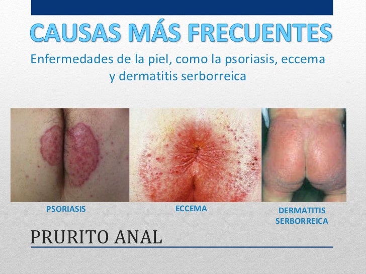 Prurito Anal 64