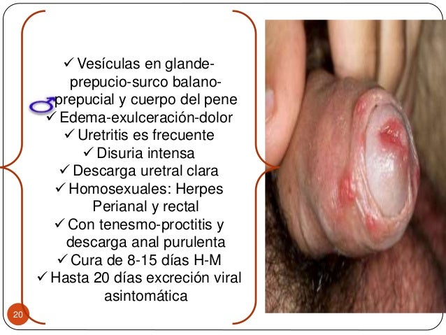 Como aumentará el espesor del miembro viril