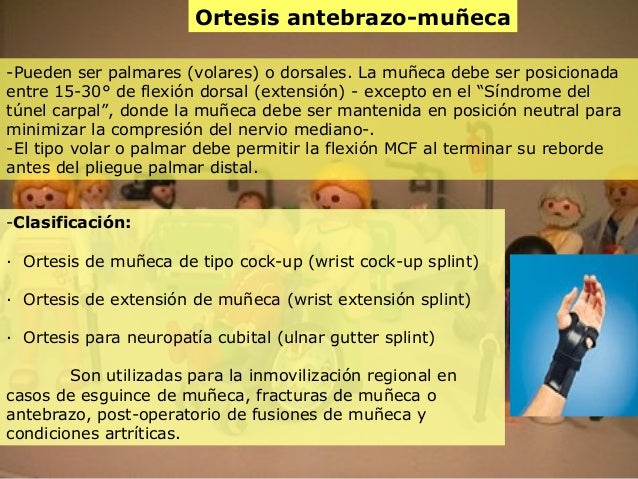 Del plástico del bridón del miembro en vologde