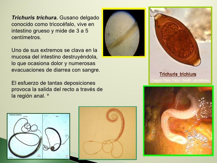 Los cistes de las lamblias los síntomas a los adultos