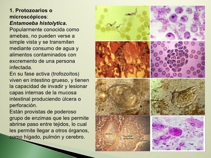 Los anticuerpos a las lamblias sumario no son descubiertos