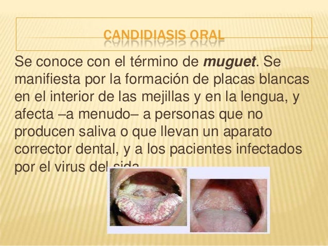 Sloyatsya las uñas la causa y el tratamiento a los niños