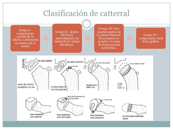 Estando sobre la espalda duele bajo el borde izquierdo