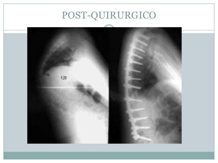 Duele un músculo sobre el cuello