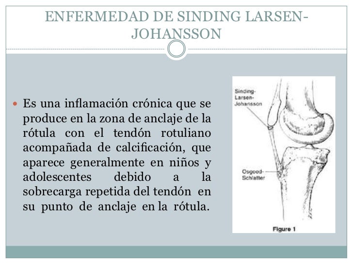 Duele los riñones da a la derecha en el lado derecho