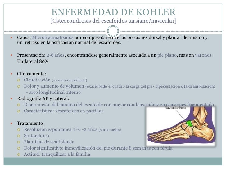 La osteocondrosis en la parte lumbar del ejercicio