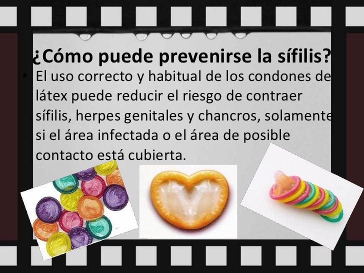 Como curar la psoriasis en las rodillas al niño