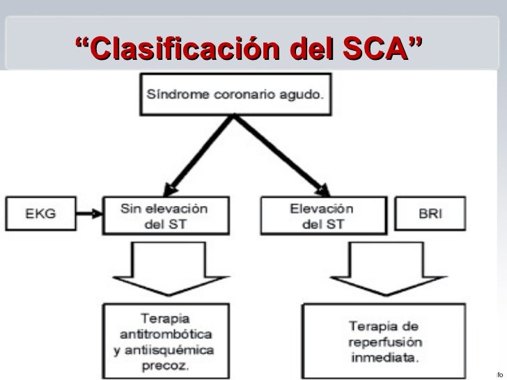 Sindrome Coronario Agu...
