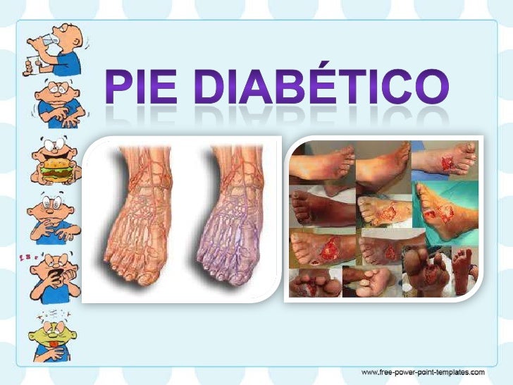 Cuidados de enfermería en pie diabetico