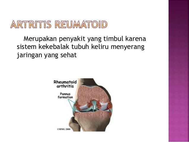 Tulang dan Persendian