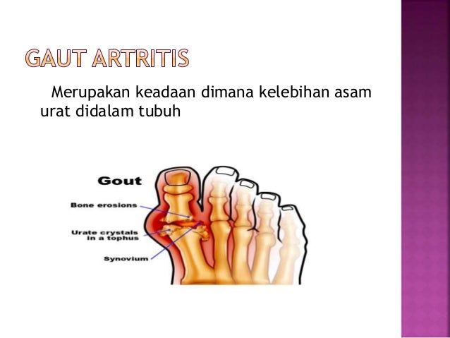 Tulang dan Persendian