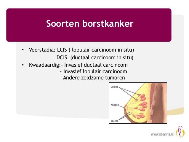 Presentatie videospreekuur borstzorg