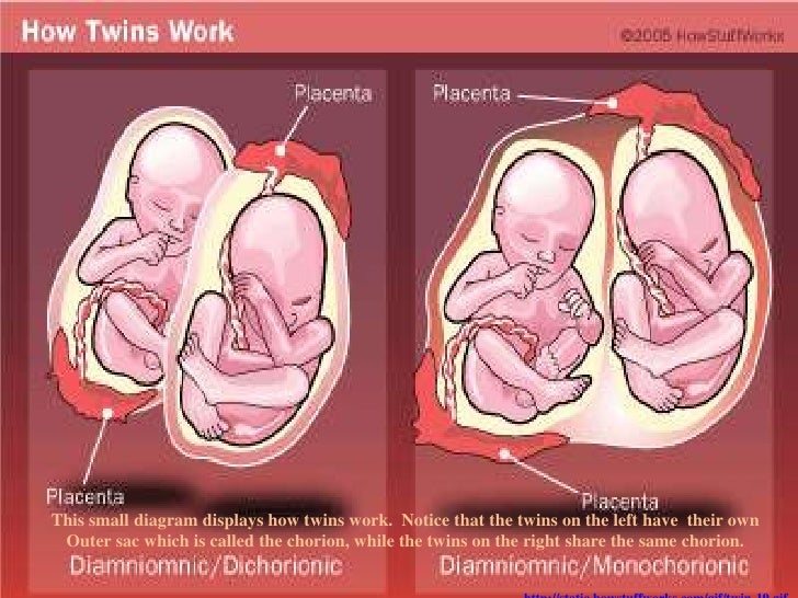 bio wiki Twin Absorption