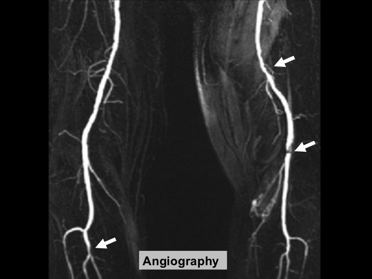 angiography 21 ...