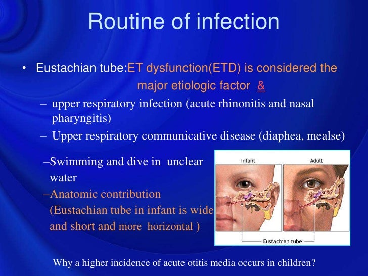 Ppt Otitis Media And Eustachian Tube Dysfunction All Otitis Is Not