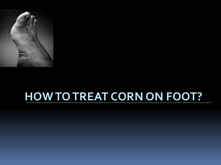 Pictures of Skin Diseases and Problems - Corns