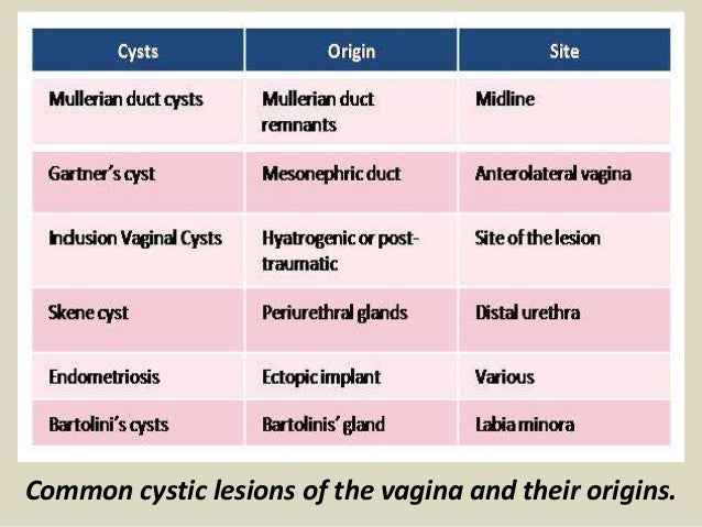 Presentation1.pptx, ultrasound examination of the uterus and ovaries.