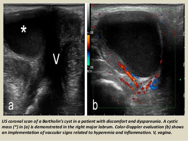 presentation1pptx ultrasound examination of the uterus and ovaries 23 638