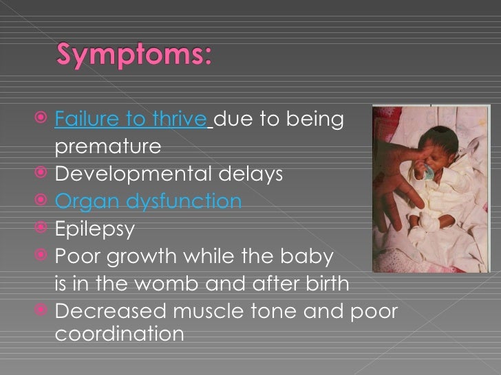 Fetal Alchohol Syndrome