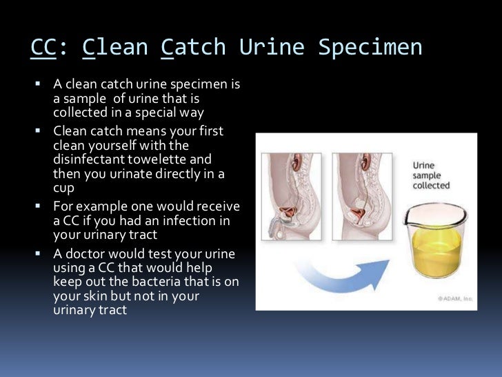 Cialis Urine Flow