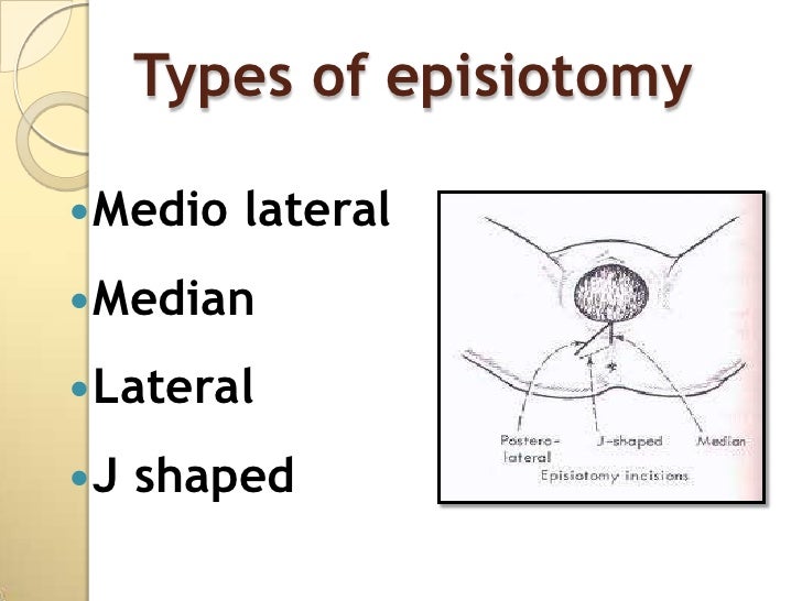 Presentation episiotomy