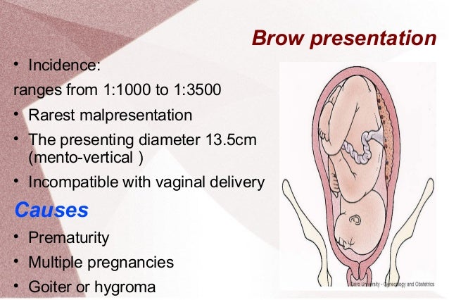 Presenting presentation