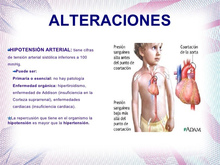 Flebektomiya antes de la operación de la foto
