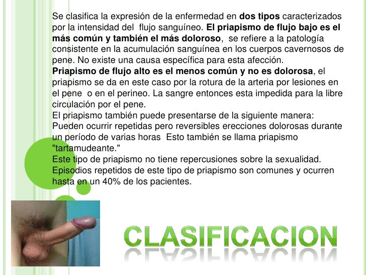 El aumento del miembro con el método por la cirugía