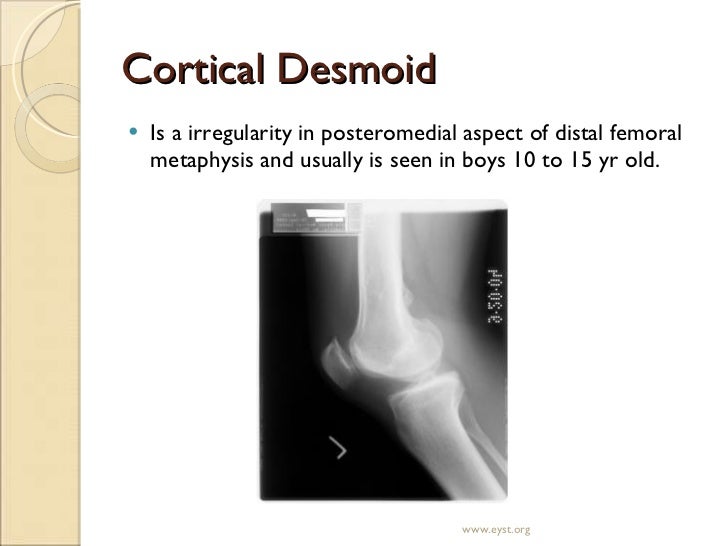 mri of knee