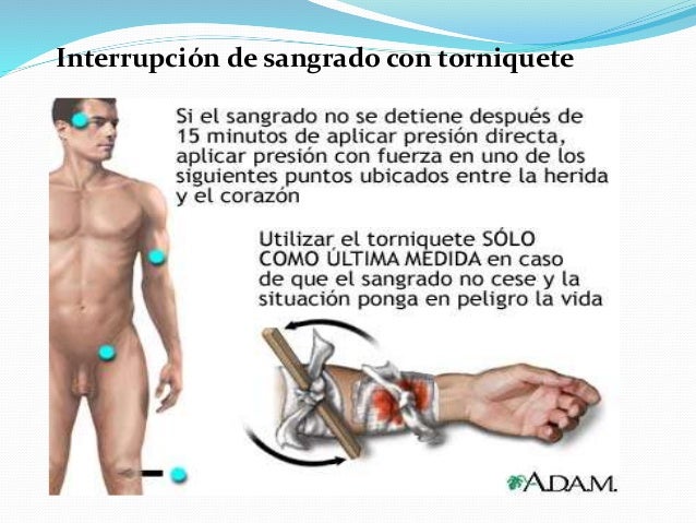 Se puede se ocupa sobre las maquetas de entrenamiento si varicoso