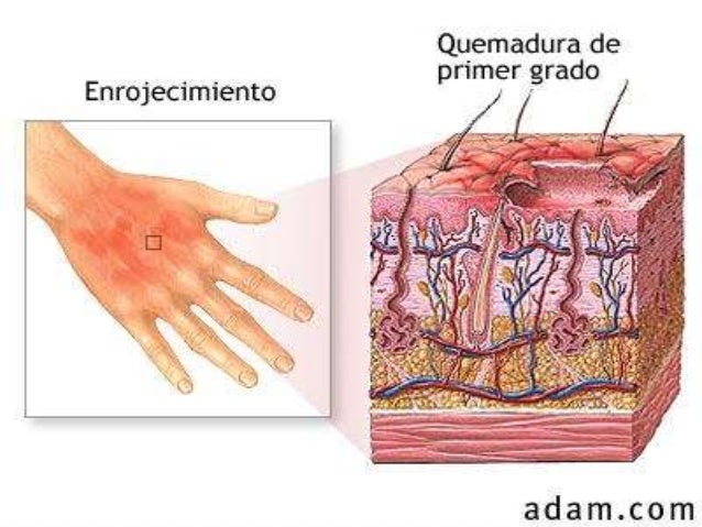 El tratamiento forzado del alcoholismo 2011