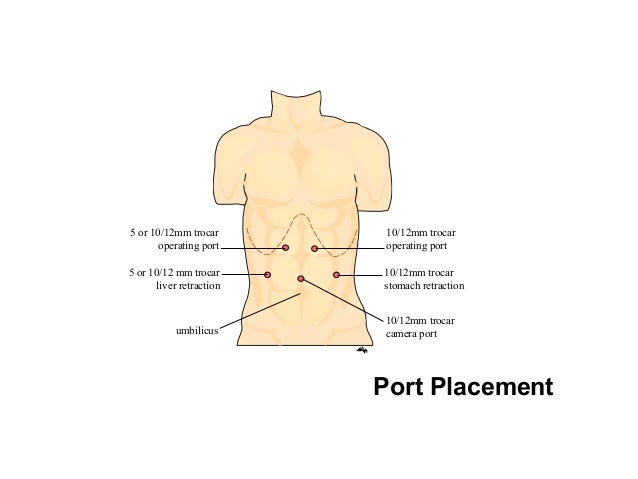 port placement