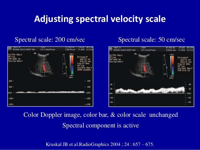 Discussion on this topic: How to Use an Ultrasound Transducer, how-to-use-an-ultrasound-transducer/ Forum on this topic: How to Use an Ultrasound Transducer, how-to-use-an-ultrasound-transducer/