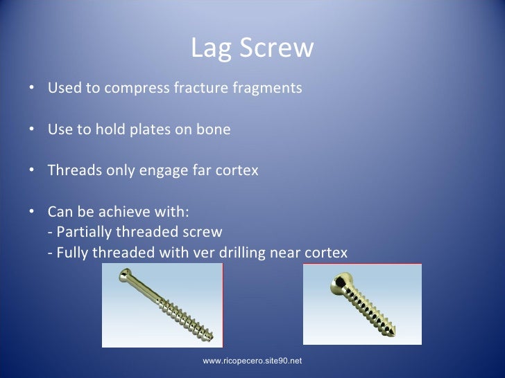 Principles Of Lag Screw + Platting