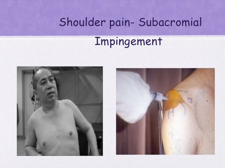 stroke signs and symptoms assessment