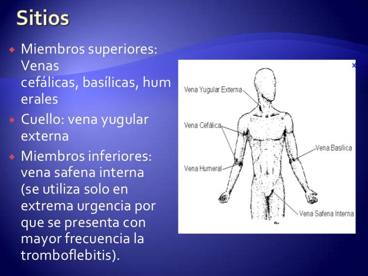 El síndrome de la dependencia del alcohol por mkb-10