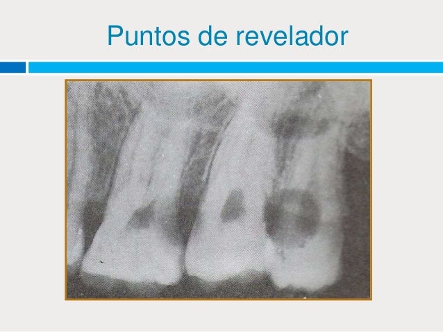 Procesamiento de película radiográfica