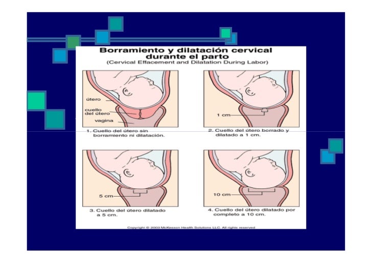 Hipotesis actual: Desde las 35 semanas Progesterona Estradiol Prostaglandina ...