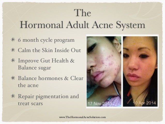 hormones skin care skin routines skin treatments www 