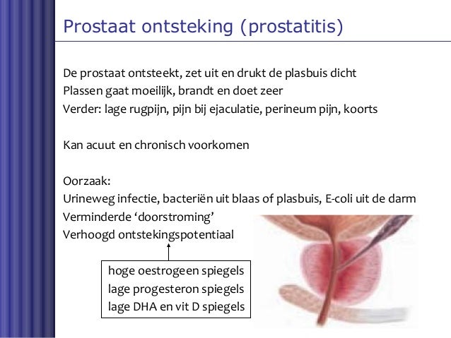 prostaat prostaat