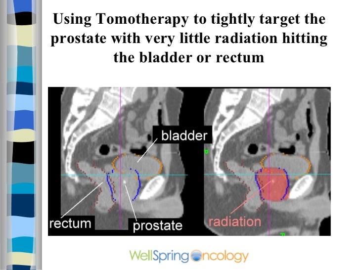 how to hit prostate gland how to hit prostate gland