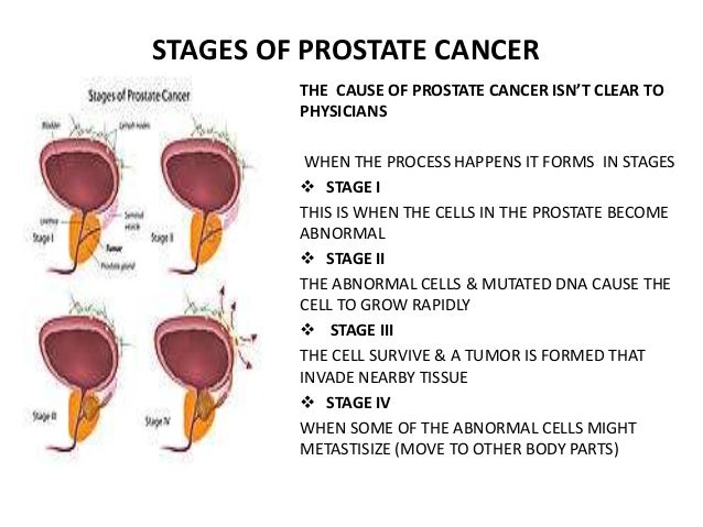 the cause and effect of prostate cancer