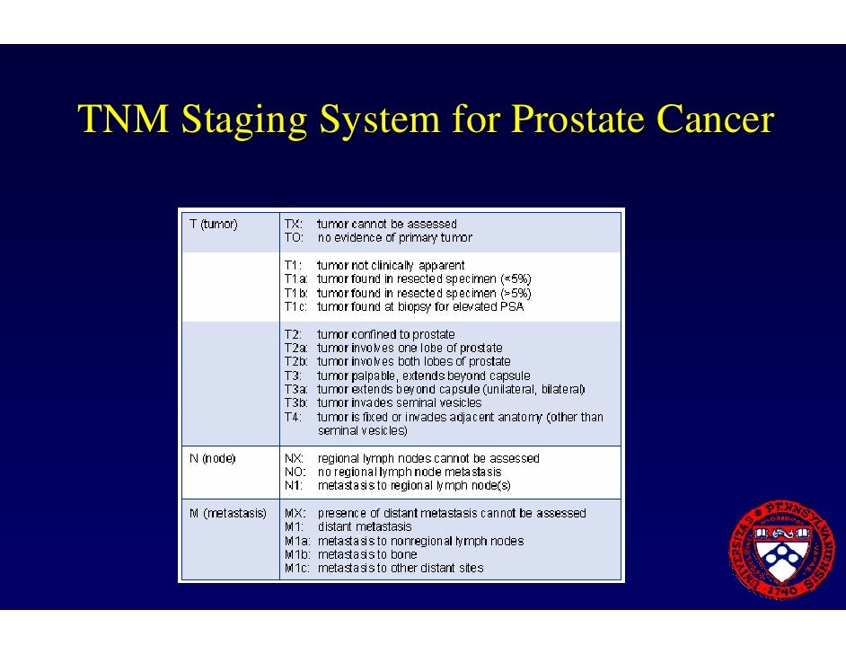 Prostate Cancer Overview breast-mass-with-enlarged-lymph-nodes-shop-laseb-fae-ufmg-br