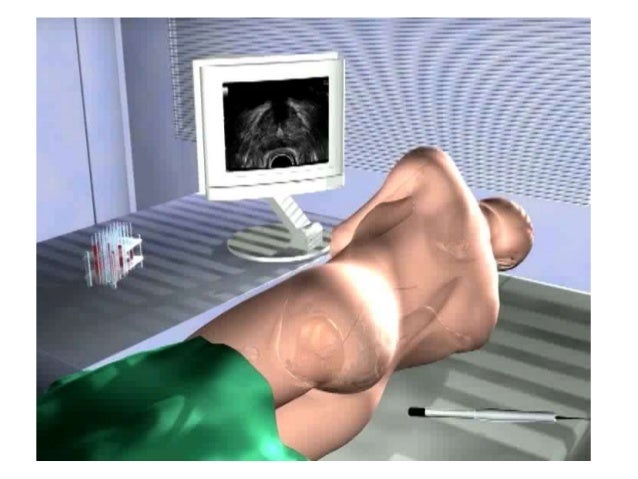 cancer le commercial enterprise des labos most cancers du rein définition