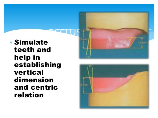 clinical procedure in complete denture