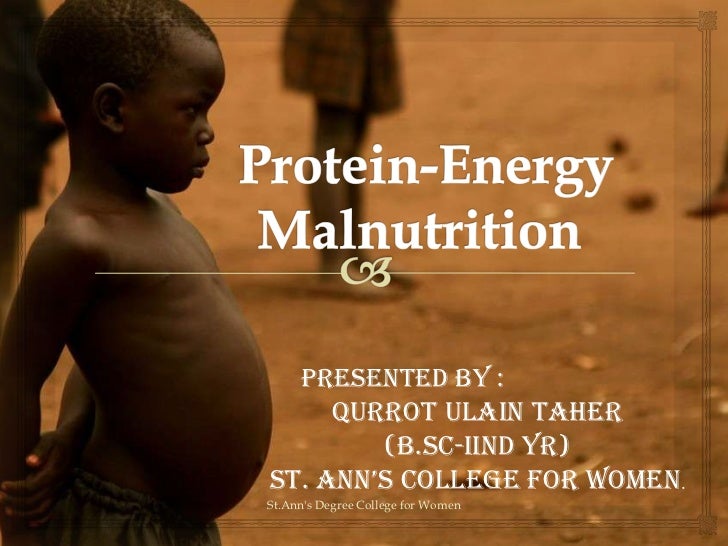 Protein Energy Malnutrition